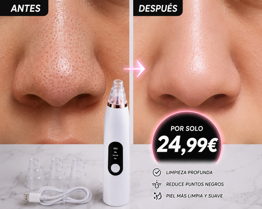 LIMPIADOR DE POROS FACIAL MEDIANTE SUCCIÓN